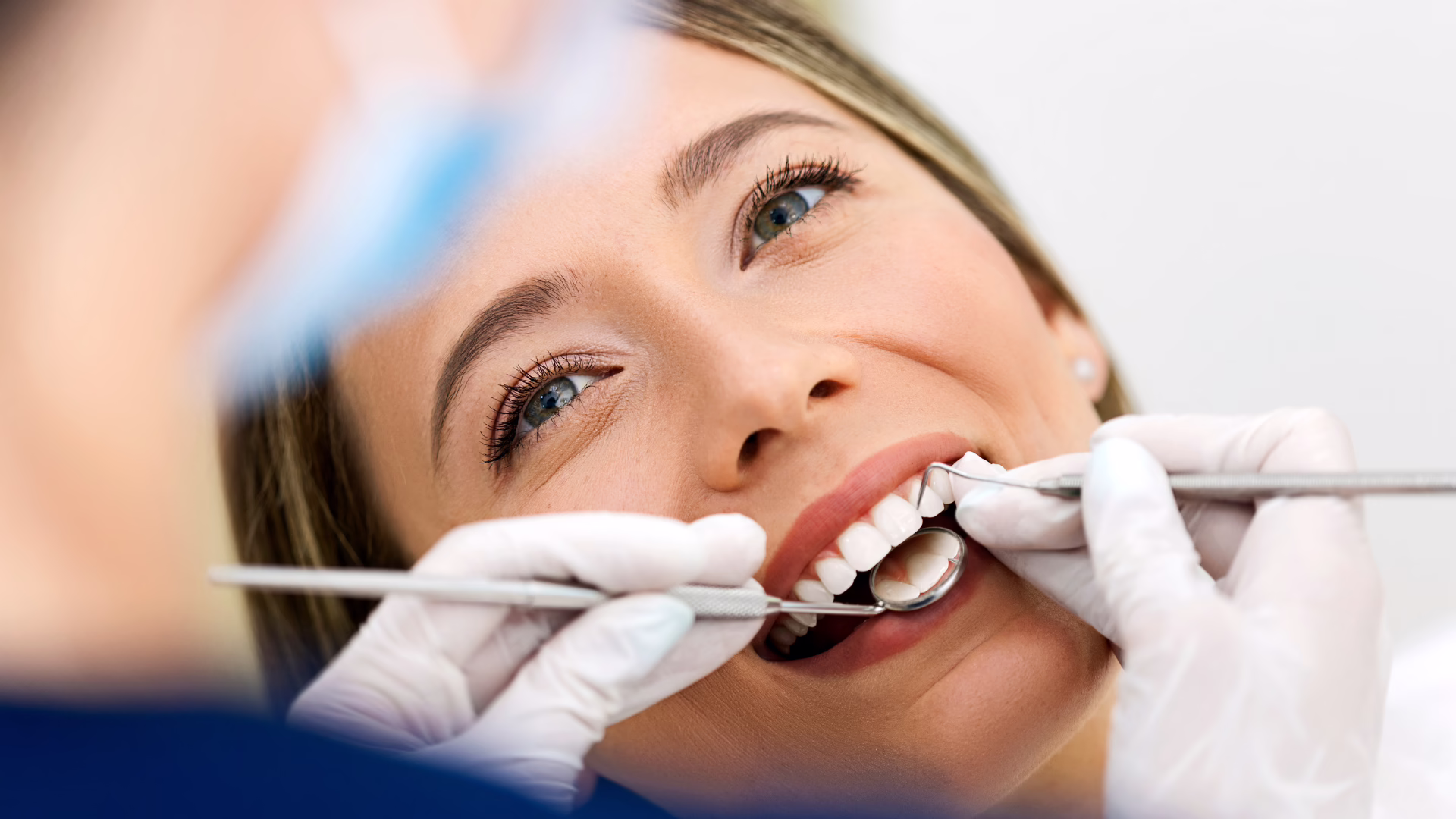 Do I Need Dental Insurance?